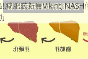 盘前飙升5%!减肥药新贵Viking NASH候选药VK2809大获成功