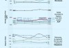 苹果推出Apple Intelligence平台：股价下跌2%，投资者反应平淡