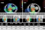 友芝友生物M701：恶性腹水治疗新突破，临床试验显示生存期显著延长