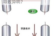 四轮定位是否会对车辆造成损伤？四轮定位不准是否会导致异响？