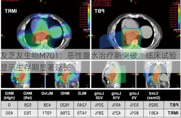 友芝友生物M701：恶性腹水治疗新突破，临床试验显示生存期显著延长