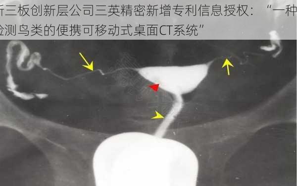 新三板创新层公司三英精密新增专利信息授权：“一种检测鸟类的便携可移动式桌面CT系统”